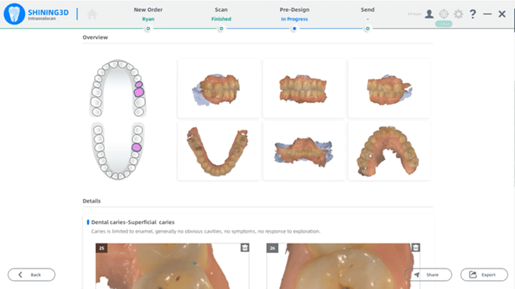 SHINING 3D Aoralscan 3 Intraoral Dental 3D Scanner