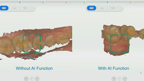 SHINING 3D Aoralscan 3 Intraoral Dental 3D Scanner