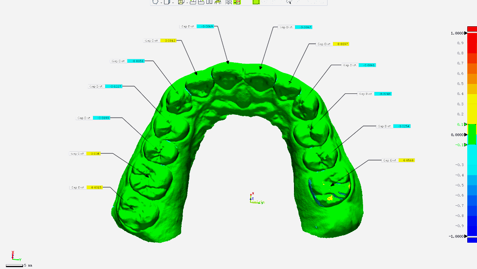 SHINING 3D Aoralscan 3 Intraoral Dental 3D Scanner